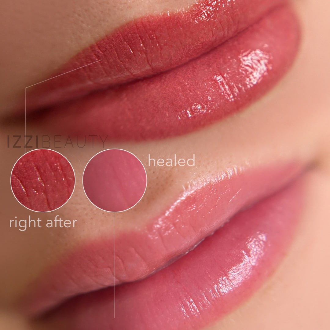 Lip pigmentatie voor en na